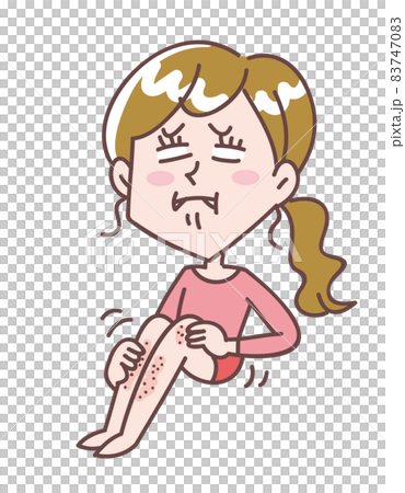 Woman with dry and itchy feet Woman with dry and itchy feet 83747083