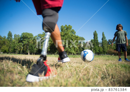 Father with prosthetic leg playing football with son Father with prosthetic leg playing football with son 83761384