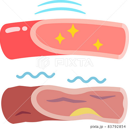 しなやかな血管と硬くなった血管のイラスト素材