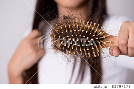 Healthy and hair loss concept. Woman holding a comb with her damaged long loss hair. Healthy and hair loss concept. Woman holding a comb with her damaged long loss hair. 83797178