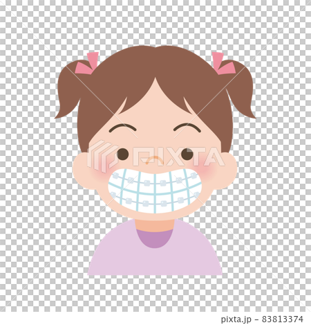 目立たない器具で歯並びの矯正をする女の子 目立たない器具で歯並びの矯正をする女の子 83813374