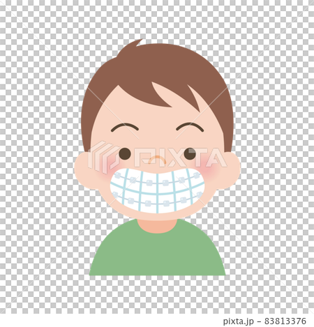 用不起眼的矯治器矯正牙列的男孩 83813376