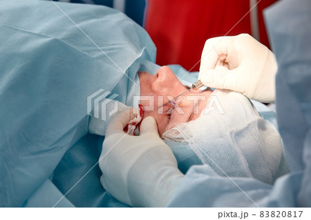 Close up of the face of a patient who is undergoing blepharoplasty. The surgeon cuts the eyelid and performs manipulations using medical instruments 83820817