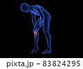 Knee Pain. Blue Human Anatomy Body 3D render on black background 83824295