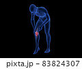 Knee Pain. Blue Human Anatomy Body 3D render on black background 83824307