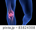 Knee Pain. Blue Human Anatomy Body 3D render on black background 83824308