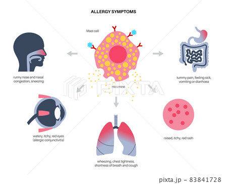 Allergy symptoms concept Allergy symptoms concept 83841728