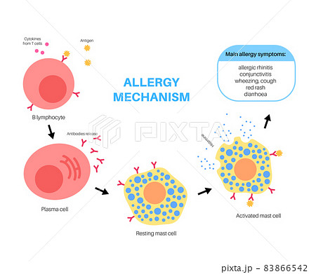 Allergy mechanism diagram 83866542