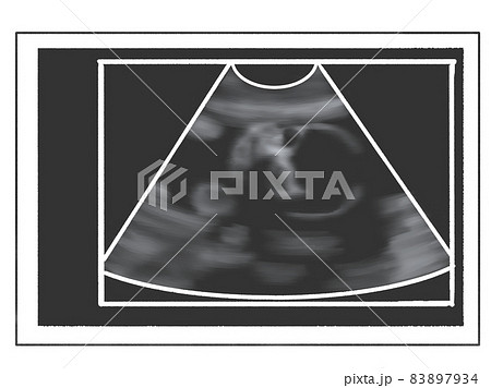 エコー写真風のイラスト　妊娠6か月（妊娠23週ごろ） 83897934