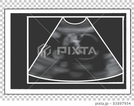 エコー写真風のイラスト　妊娠6か月（妊娠23週ごろ） 83897934