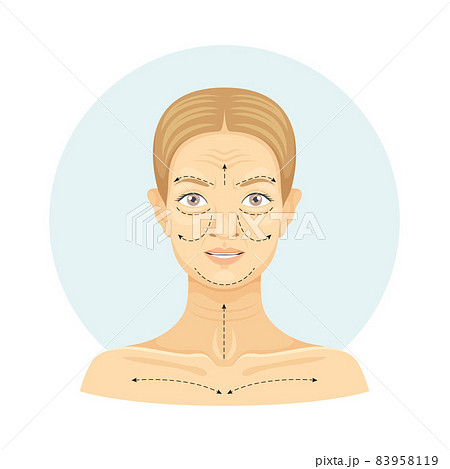 Cosmetic surgery on female face with dotted lines. Plastic surgery vector illustration 83958119
