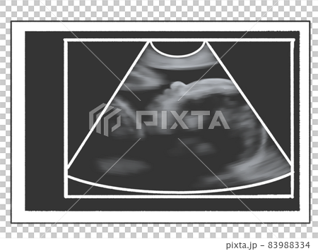Echo photo style illustration (late pregnancy) 83988334