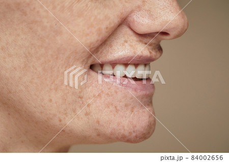Natural Smile Side View 84002656