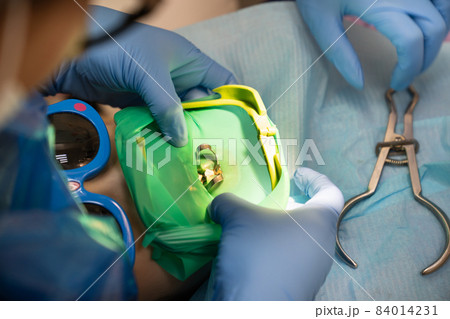 the dentist uses Cofferdam for the treatment of a child 84014231