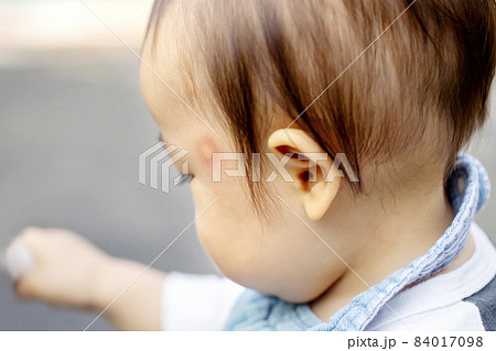 0才の男の子の横顔 蚊に刺されて赤くなっている 0才の男の子の横顔 蚊に刺されて赤くなっている 84017098