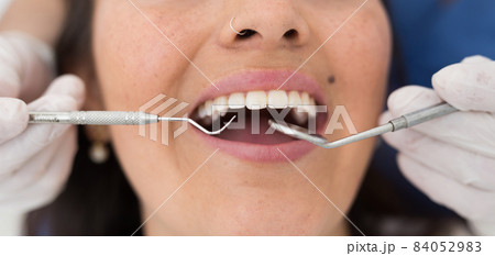 Medical checkup oral cavity of female patient 84052983
