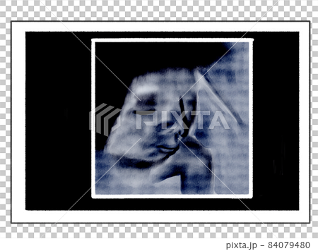 3D echo photo style illustration of late pregnancy (foetation wearing a cheek cane) 3D echo photo style illustration of late pregnancy (foetation wearing a cheek cane) 84079480