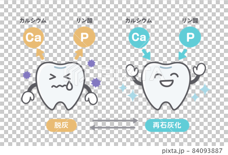 Cute tooth illustrations on decalcification and remineralization 84093887