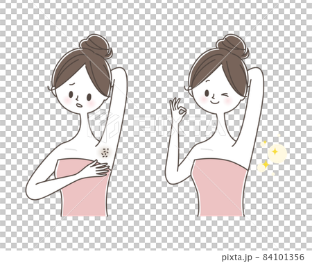 Young woman with armpit hair removal before and after 84101356
