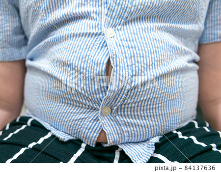 Tight shirt of obese fat boy overweight. 84137636