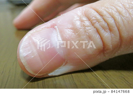 爪甲横溝 84147668