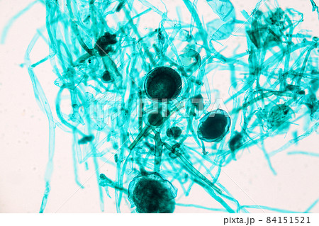 Characteristics of Rhizopus is a genus of common saprophytic fungi on Slide under the microscope for education. Characteristics of Rhizopus is a genus of common saprophytic fungi on Slide under the microscope for education. 84151521