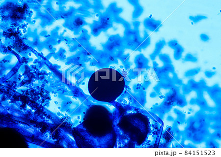 Characteristics of Rhizopus is a genus of common saprophytic fungi on Slide under the microscope for education. Characteristics of Rhizopus is a genus of common saprophytic fungi on Slide under the microscope for education. 84151523