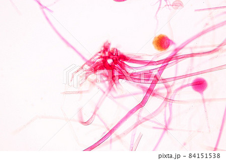 Characteristics of Rhizopus is a genus of common saprophytic fungi on Slide under the microscope for education. 84151538