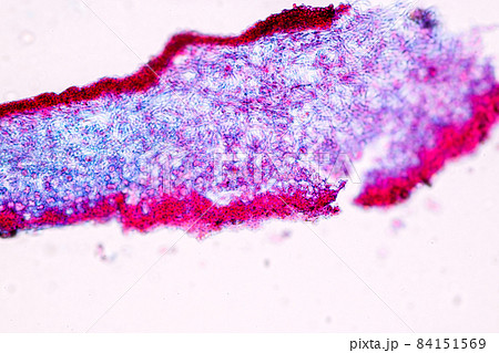 Characteristics of Lichen, hyphae and Symbiotic algae under the microscope for education. Characteristics of Lichen, hyphae and Symbiotic algae under the microscope for education. 84151569
