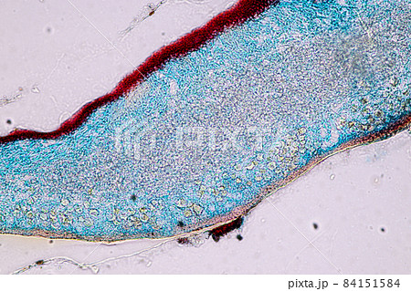 Characteristics of Lichen, hyphae and Symbiotic algae under the microscope for education. Characteristics of Lichen, hyphae and Symbiotic algae under the microscope for education. 84151584