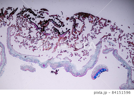 Characteristics of Lichen, hyphae and Symbiotic algae under the microscope for education. 84151596