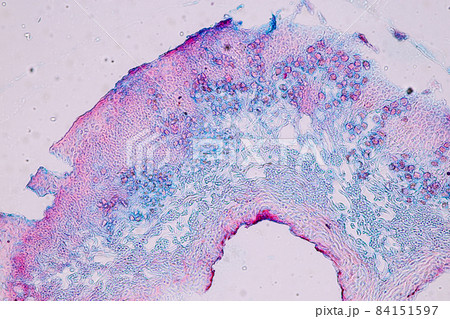 Characteristics of Lichen, hyphae and Symbiotic algae under the microscope for education. 84151597