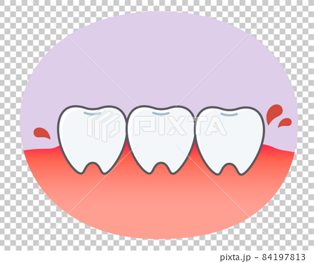 歯肉炎の歯や歯茎の可愛いイラストのイラスト素材
