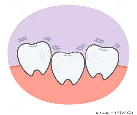 歯並びに悩む歯のシンプルで可愛いイラストのイラスト素材