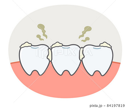 歯垢に悩む歯や歯茎のシンプルで可愛いイラストのイラスト素材