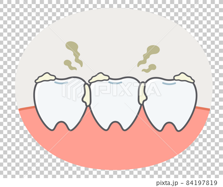 歯垢に悩む歯や歯茎のシンプルで可愛いイラストのイラスト素材