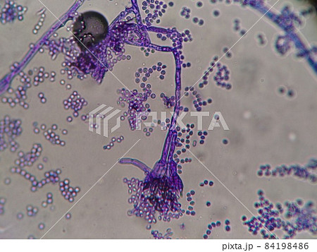 青かびチーズのペニシリウム分生子顕微鏡写真 84198486