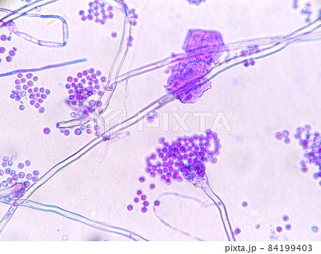 青かび分生子顕微鏡観察 84199403