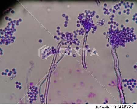 カビの菌糸が伸びているところ カビの菌糸が伸びているところ 84219250