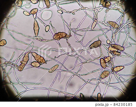 ススカビの顕微鏡写真 ススカビの顕微鏡写真 84230185