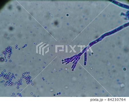 ペニシリウムの骨格顕微鏡写真 84230764