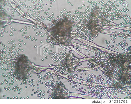 青かびの顕微鏡写真 青かびの顕微鏡写真 84231791