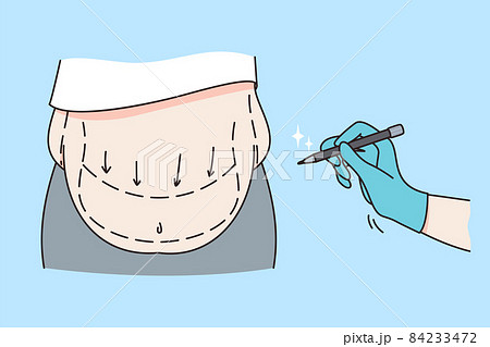 Body care and liposuction concept. 84233472