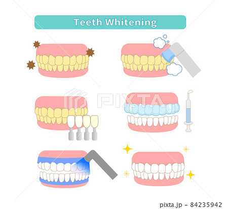 歯のホワイトニングのイラストのイラスト素材