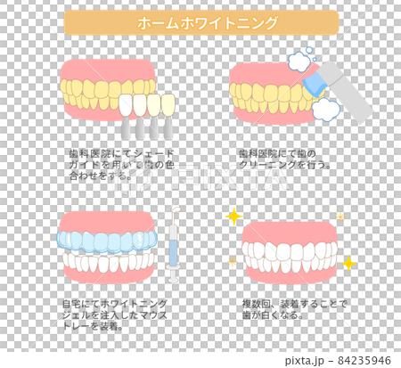 ホームホワイトニング　歯のホワイトニングのイラスト 84235946
