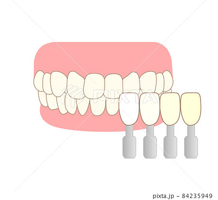 歯のホワイトニング シェードガイドのイラストのイラスト素材