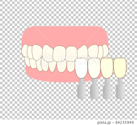 牙齒美白遮陽指南的插圖 84235949