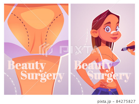 Beauty surgery cartoon poster, plastic liposuction 84275827