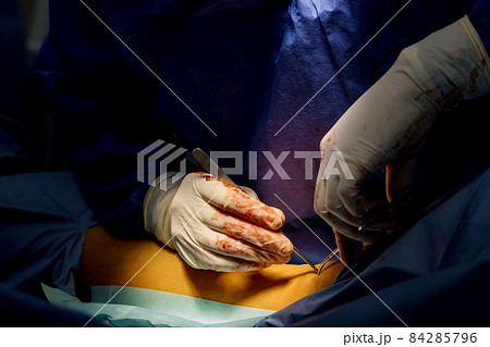Doctor surgeon prepared leg for surgery with hospital emergency operating room Doctor surgeon prepared leg for surgery with hospital emergency operating room 84285796