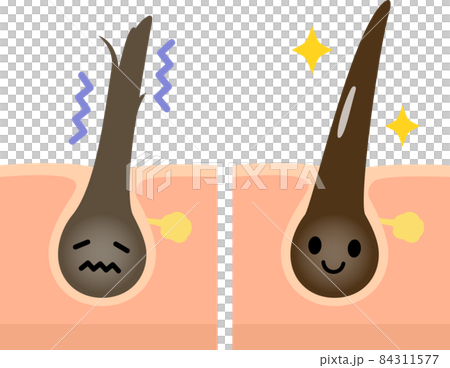 受損的頭髮和健康的頭髮特徵 84311577